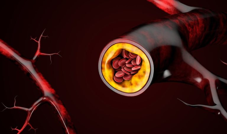 Cholesterol Ldl Taux A Ne Pas Depasser Cholestérol : comment le faire baisser